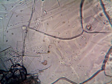 mikroorganizma fotoğrafı mikroskopla yapıldı.