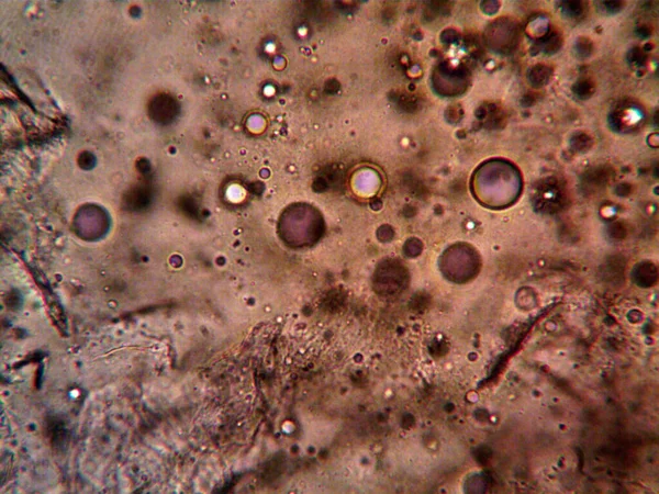显微镜下拍摄的微生物照片 — 图库照片