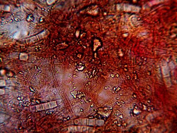 Φωτογραφία Μικροοργανισμού Κατασκευασμένη Μικροσκόπιο — Φωτογραφία Αρχείου