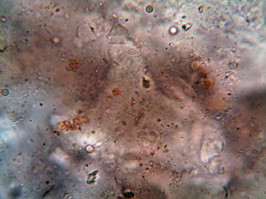 mikroorganizma fotoğrafı mikroskopla yapıldı.