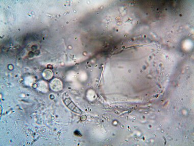 mikroorganizma fotoğrafı mikroskopla yapıldı.