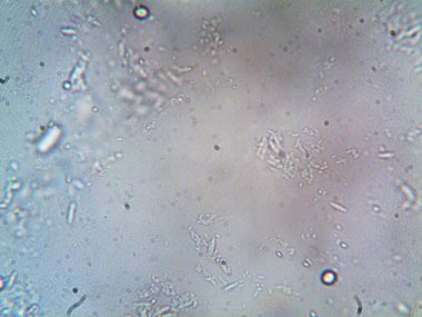 mikroorganizma fotoğrafı mikroskopla yapıldı.