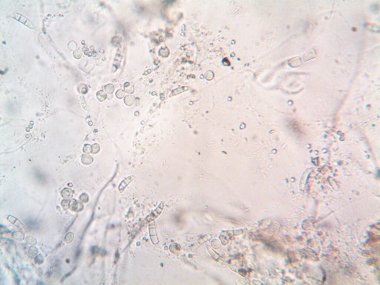 mikroorganizma fotoğrafı mikroskopla yapıldı.