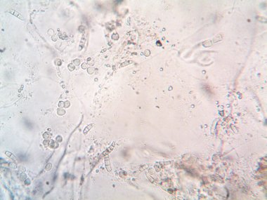 mikroorganizma fotoğrafı mikroskopla yapıldı.