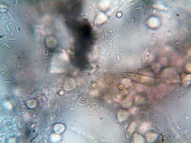 mikroorganizma fotoğrafı mikroskopla yapıldı.