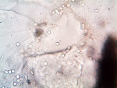 mikroorganizma fotoğrafı mikroskopla yapıldı.