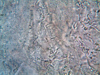 mikroorganizma fotoğrafı mikroskopla yapıldı.