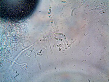 mikroorganizma fotoğrafı mikroskopla yapıldı.