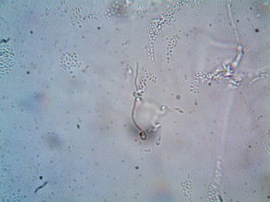 mikroorganizma fotoğrafı mikroskopla yapıldı.