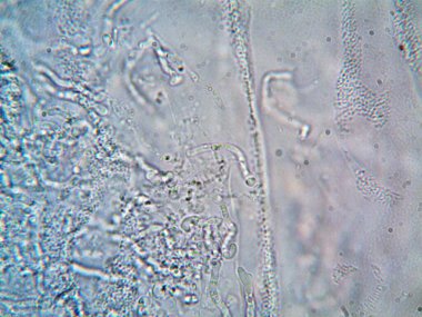 mikroorganizma fotoğrafı mikroskopla yapıldı.