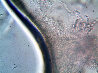 mikroorganizma fotoğrafı mikroskopla yapıldı.