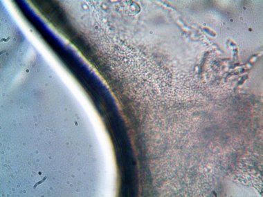 mikroorganizma fotoğrafı mikroskopla yapıldı.