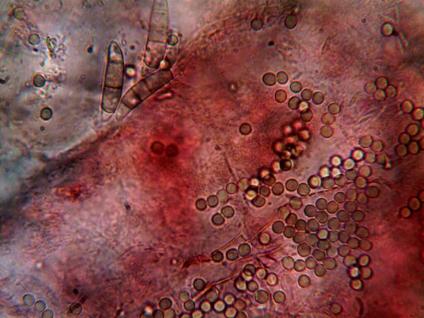 Foto Del Microrganismo Fatta Microscopio — Foto Stock