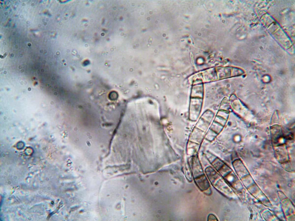 Foto Del Microrganismo Fatta Microscopio — Foto Stock