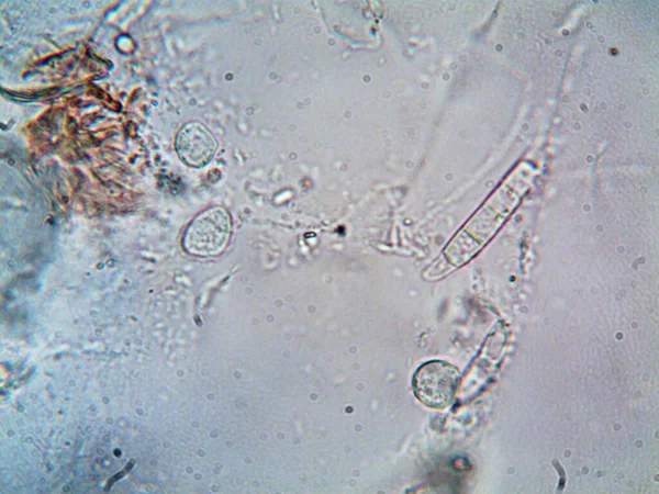 Φωτογραφία Μικροοργανισμού Κατασκευασμένη Μικροσκόπιο — Φωτογραφία Αρχείου