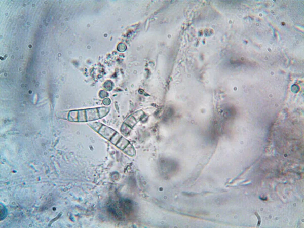 Microorganismo Foto Hecha Por Microscopio —  Fotos de Stock