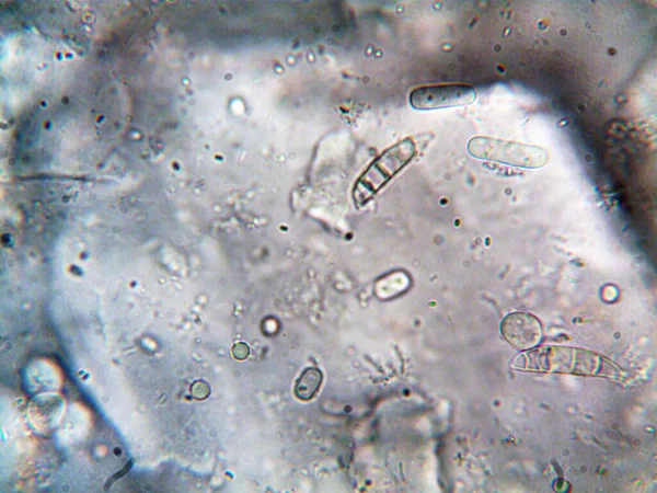 顕微鏡で撮影した微生物写真 — ストック写真