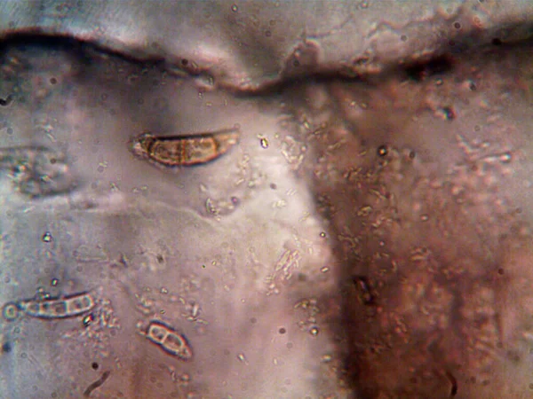 显微镜下拍摄的微生物照片 — 图库照片