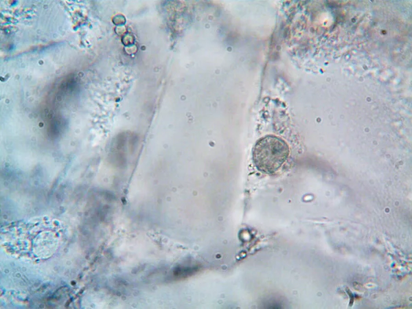 显微镜下拍摄的微生物照片 — 图库照片