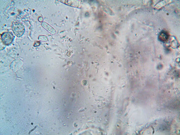 Foto Mikroorganisme Yang Dibuat Oleh Mikroskop — Stok Foto