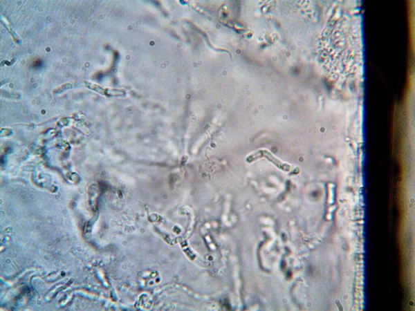 Microorganismo Foto Hecha Por Microscopio —  Fotos de Stock