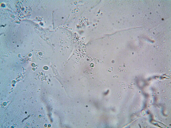 Fotografie Mikroorganismu Pořízená Mikroskopem — Stock fotografie