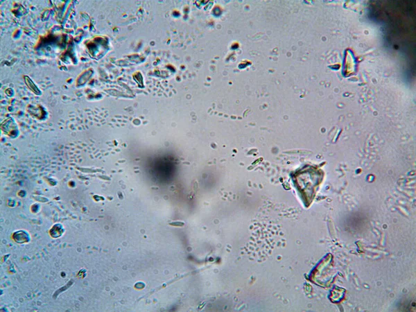 Mikroorganismus Foto Unter Dem Mikroskop — Stockfoto