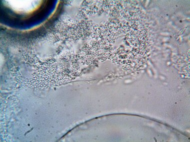 mikroorganizma evimde bulundu.