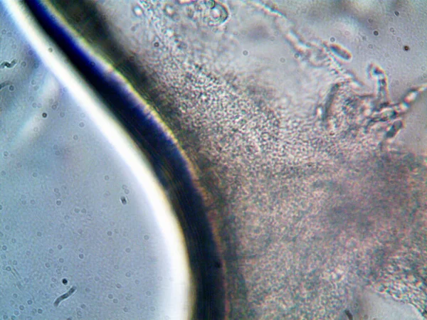 mikroorganizma evimde bulundu.