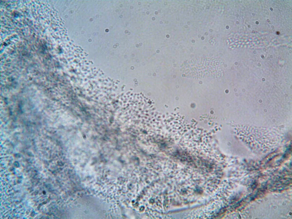 Mikroorganismus Nalezený Doma — Stock fotografie