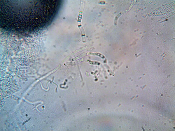 mikroorganizma evimde bulundu.