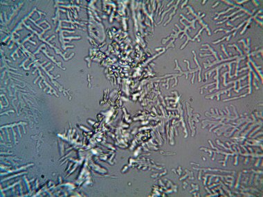 Evden çıkarılan mikro kristaller