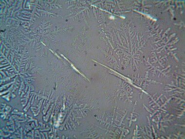 Evden çıkarılan mikro kristaller