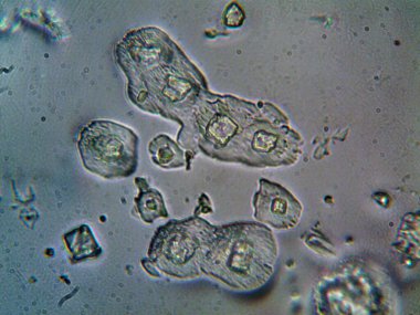 Evden çıkarılan mikro kristaller