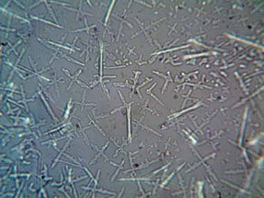 Evden çıkarılan mikro kristaller