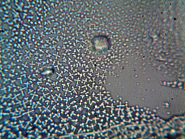 Microkristallen Die Thuis Worden Geëxtraheerd — Stockfoto