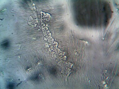 Evden çıkarılan mikro kristaller