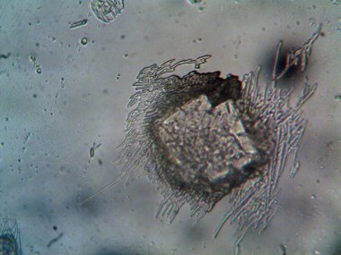 Evden çıkarılan mikro kristaller