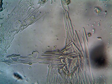 Evden çıkarılan mikro kristaller