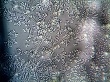 Evden çıkarılan mikro kristaller