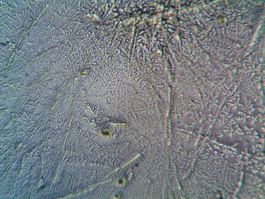 Evden çıkarılan mikro kristaller