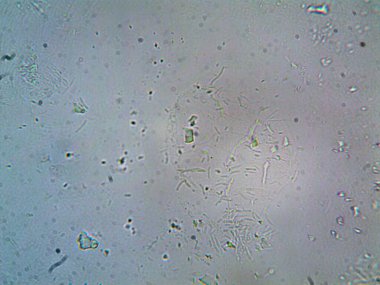 Duşumun altındaki boruda bulunan mikroorganizma.