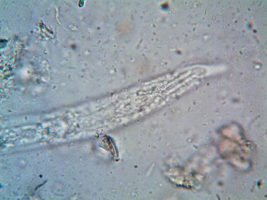 Duşumun altındaki boruda bulunan mikroorganizma.
