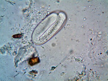 Duşumun altındaki boruda bulunan mikroorganizma.