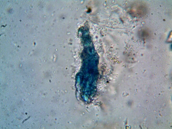 Микроорганизм Найденный Трубе Моим Душем — стоковое фото