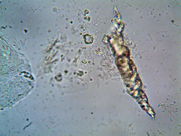 Mikroorganismus Nalezen Trubce Pod Sprchou — Stock fotografie