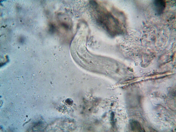 私のシャワーの下のパイプに見つかった微生物 — ストック写真