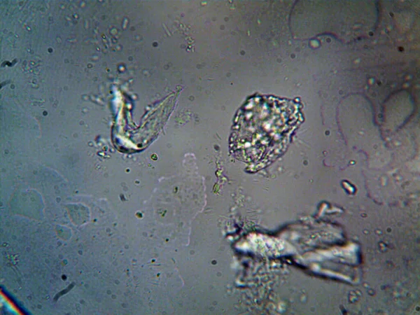 Mikroorganizm Znaleziony Rurze Pod Prysznicem — Zdjęcie stockowe