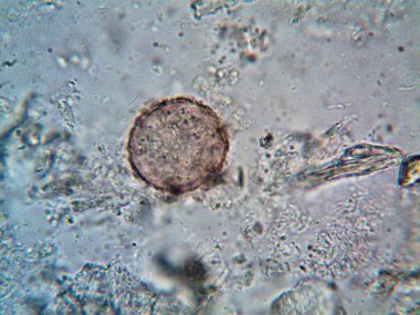 Duşumun altındaki boruda bulunan mikroorganizma.