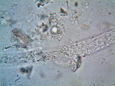 Duşumun altındaki boruda bulunan mikroorganizma.